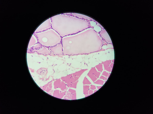 Parathyroid Thyroid Slides - Parathyroid_Thyroid 010 400X
